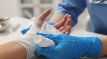 Burns management in primary care