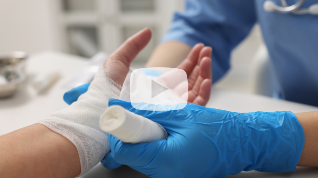 Burns management in primary care