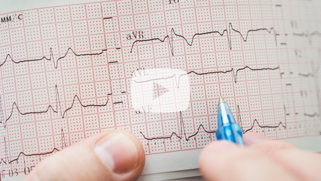 ECGs and what they mean